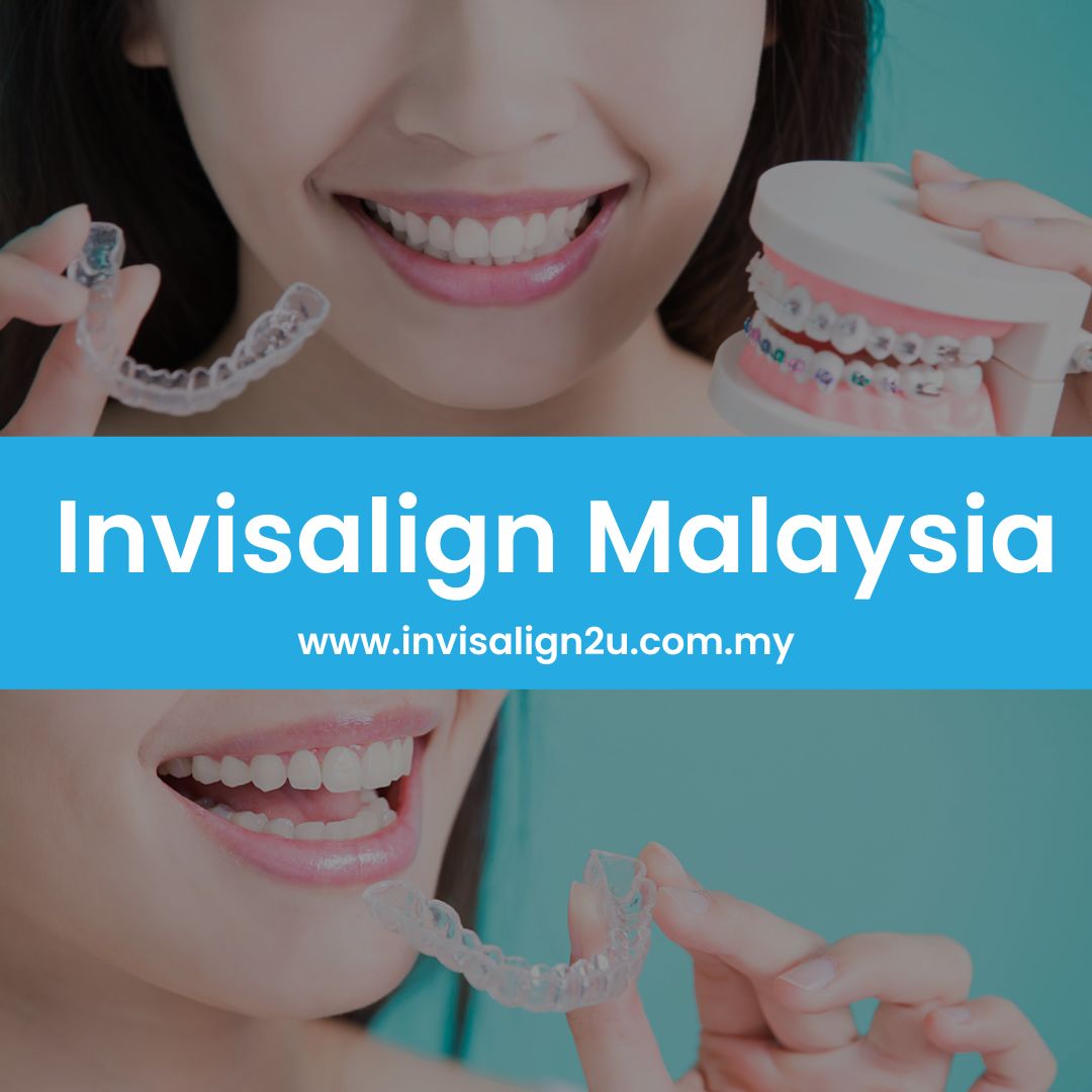 Invisalign Malaysia Best Invisible Braces & Price [2024]