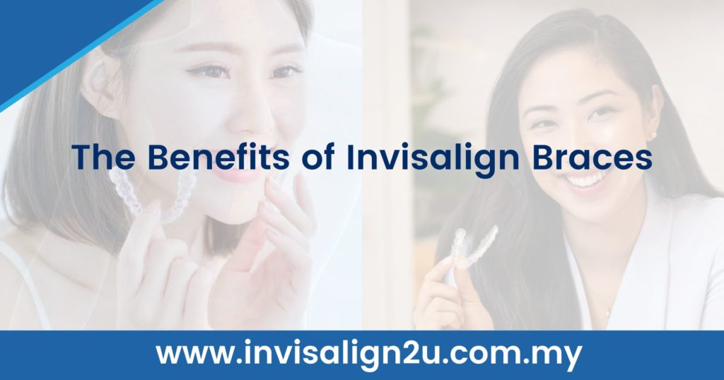The Benefits of Invisalign Braces