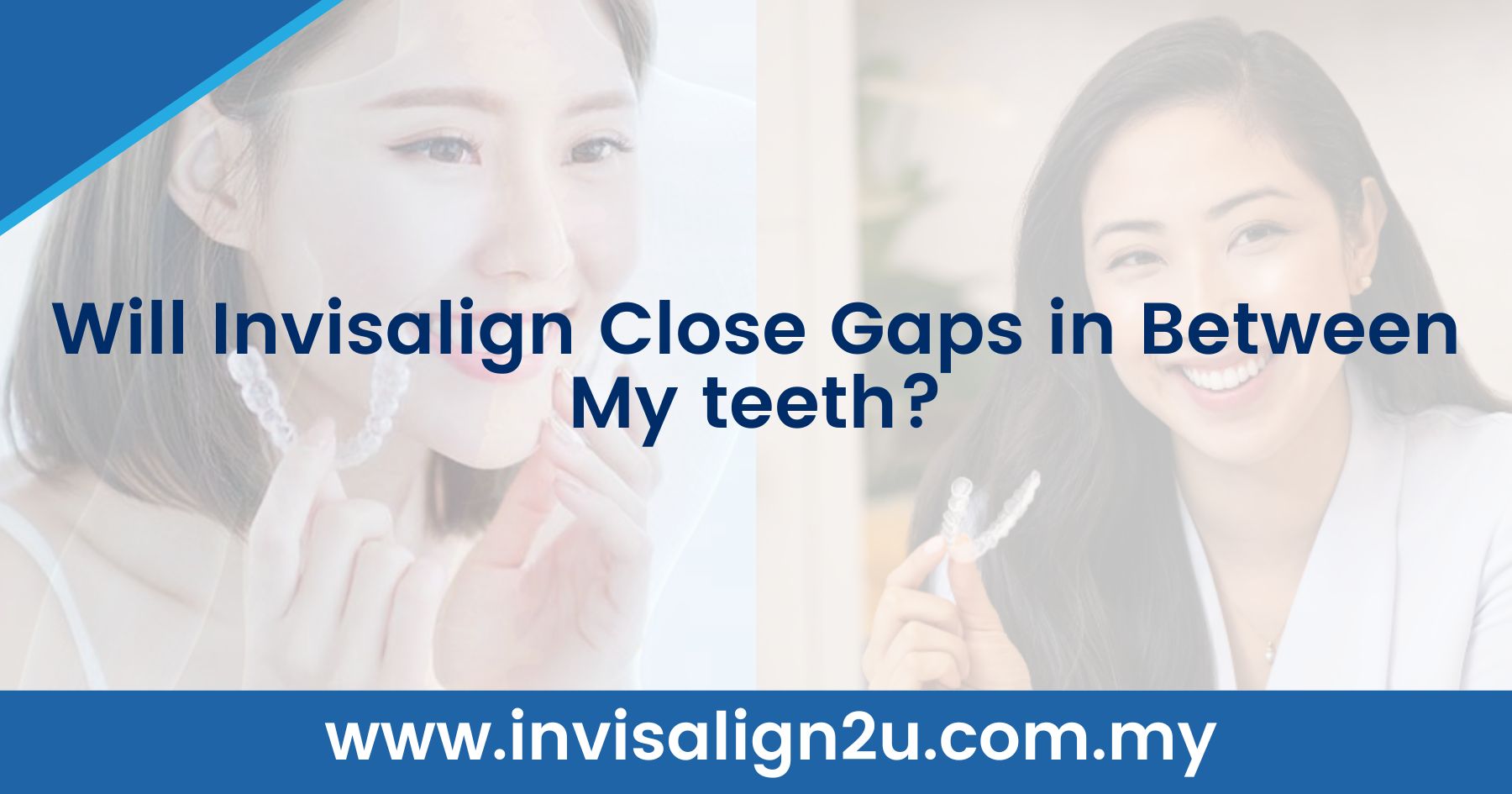 Will Invisalign Close Gaps in Between My teeth